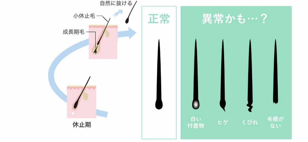 山下針灸房 姫路市で鍼灸 不妊鍼灸のことならお任せ下さい