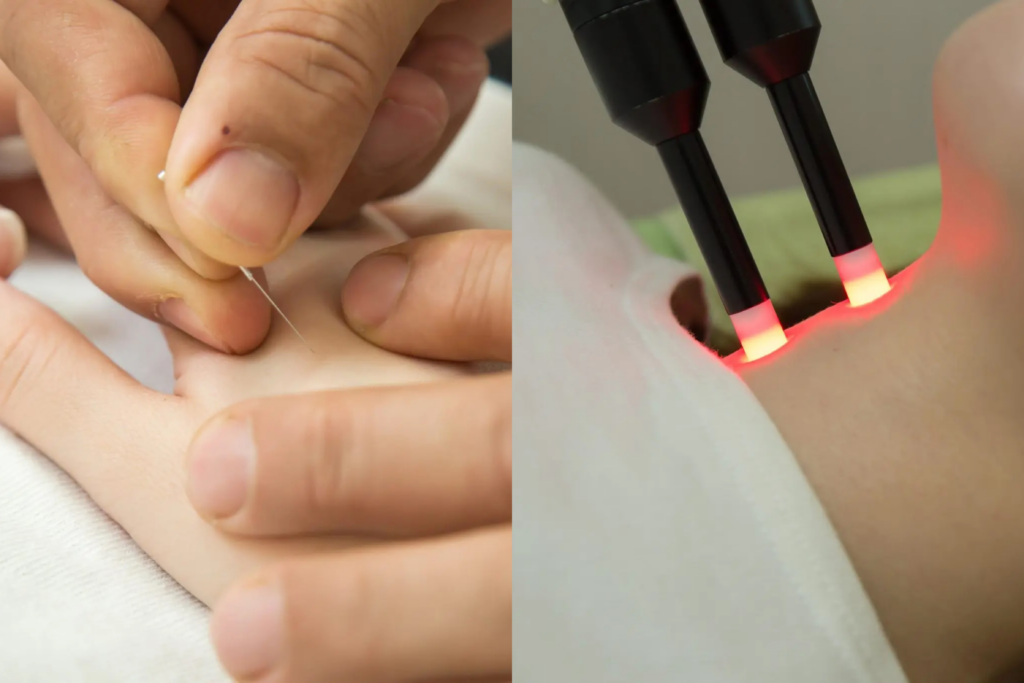 手のツボへ細い鍼を打つ施術と、首元へレーザープローブを当てる施術の組み合わせ|妊活サポート(山下針灸房・姫路市)